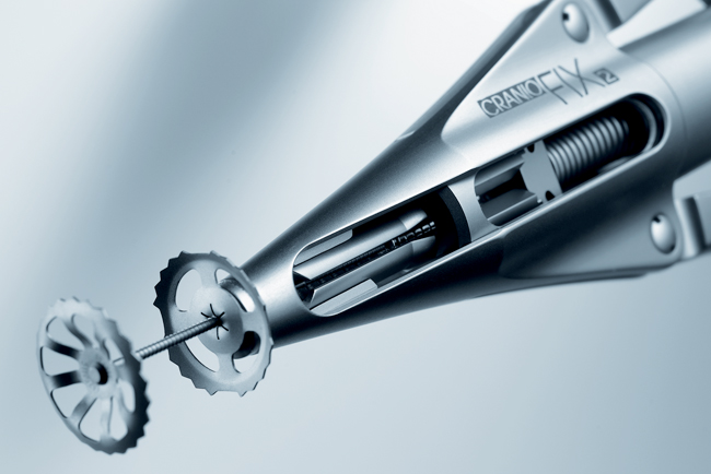 Close-up of CranioFix® 2 Titanium Clamp System